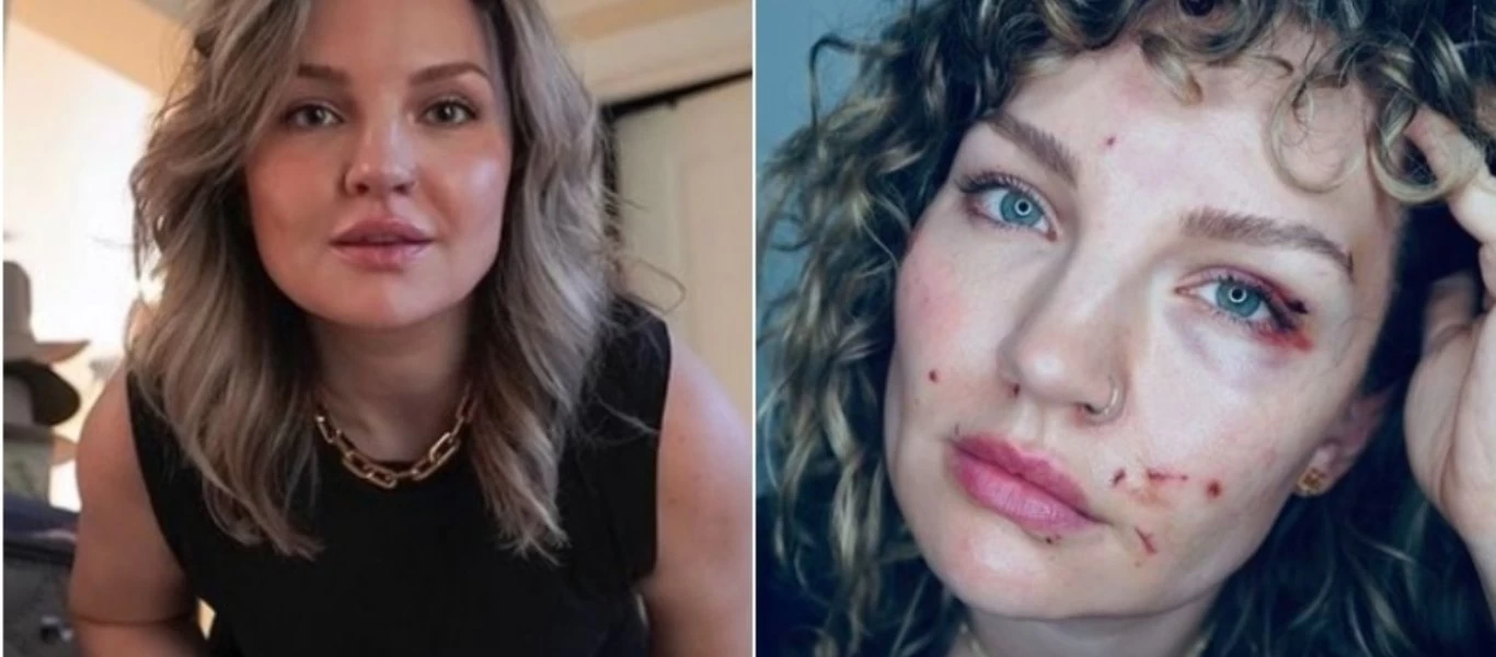 Εβγένια Τιχόνοβα: H εικόνα που πόσταρε και... τρόμαξε τους followers της (φωτό)